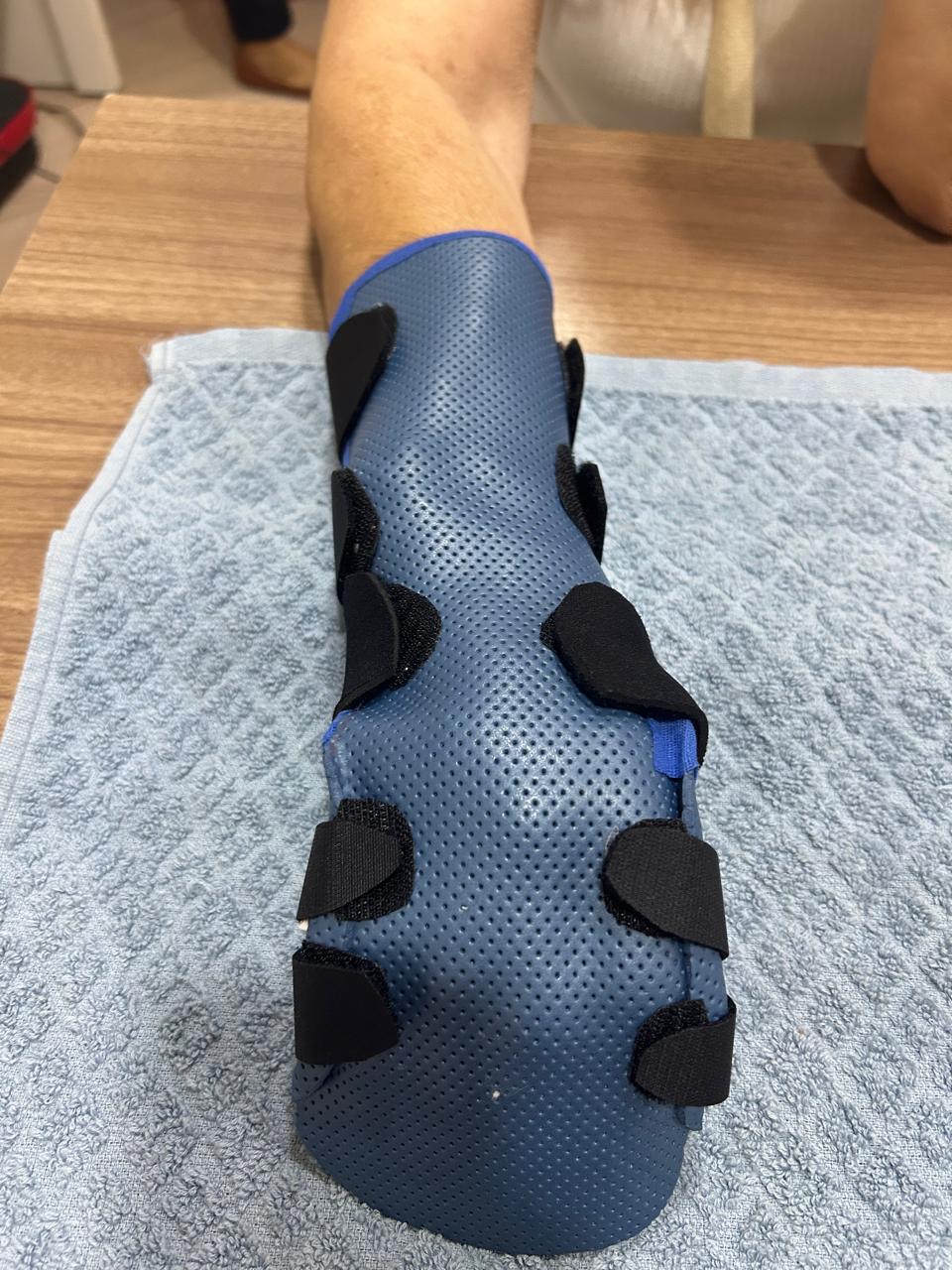 Órtese longa de antebraço em termoplástico